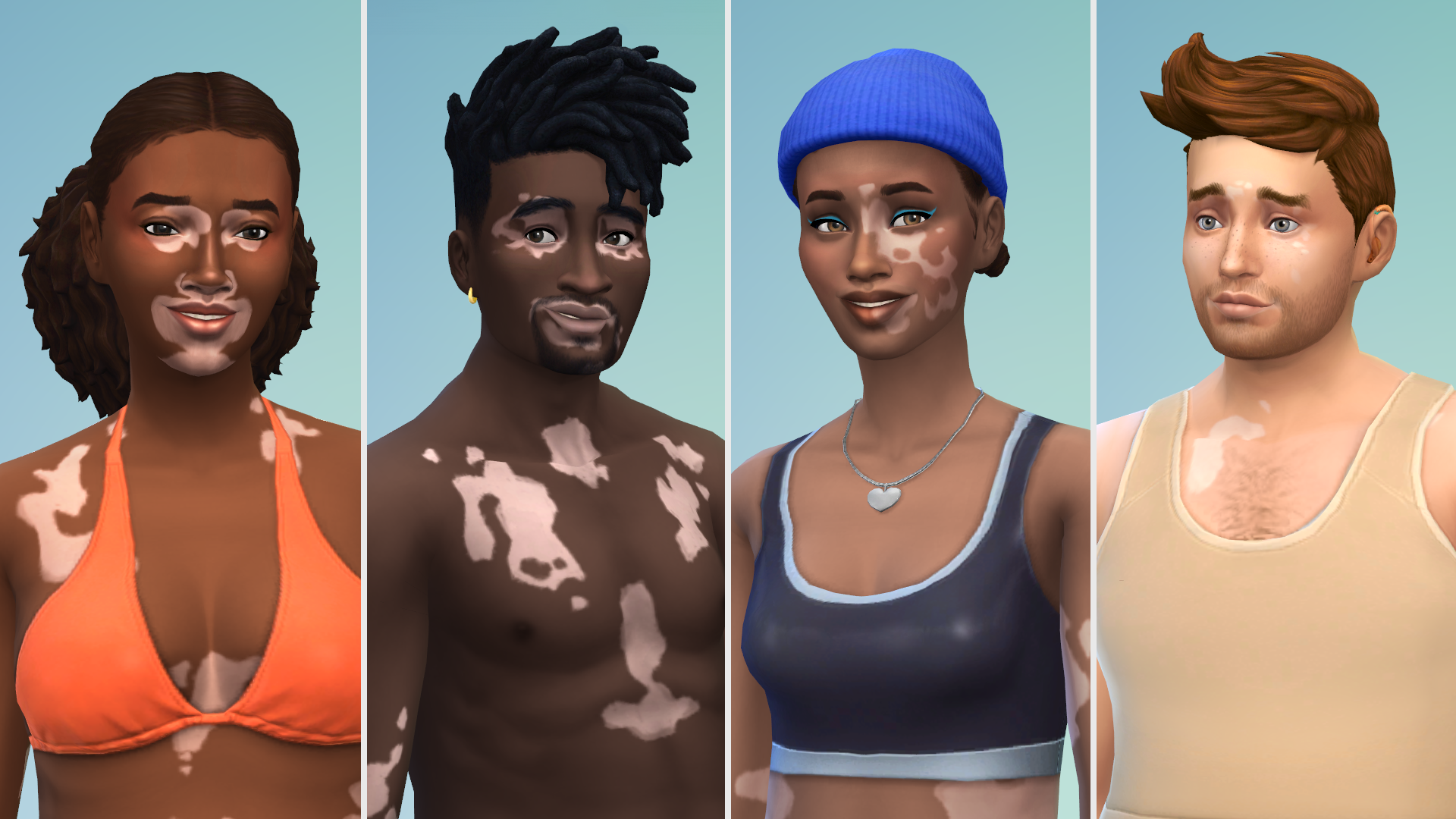 A composite of four Sims with vitiligo.
