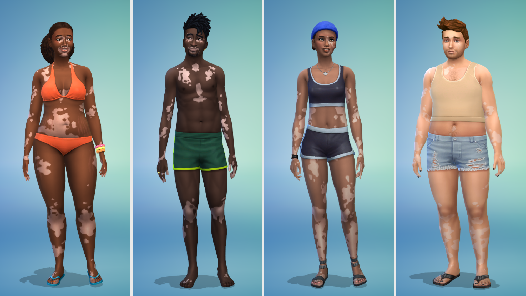 A composite of four full body images of Sims with vitiligo.